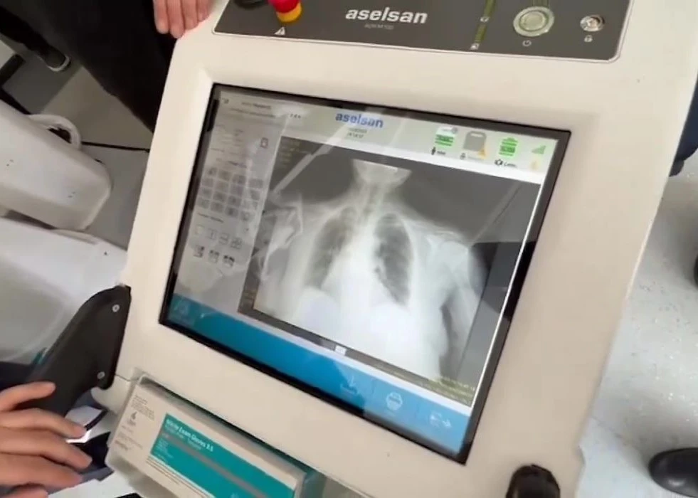 ASELSAN Adapts its Technology to Medicine: ADR-M100
